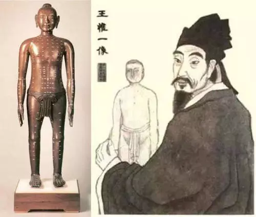 王惟一發(fā)明并鑄造<em>針灸</em>銅人