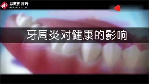 牙周炎病變過(guò)程及刮治，3D動(dòng)畫演示